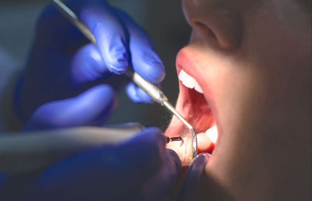 A Gamechanger in the Fight Against Gum Disease Could Be on the Way Image